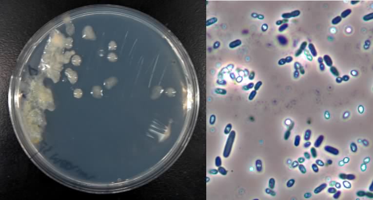 Azotobacter - Beneficial Microbes