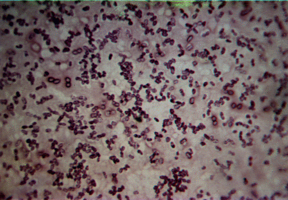 jillian aerobic is usually spherical of Azotobacter oval a motile, genus bacteria or